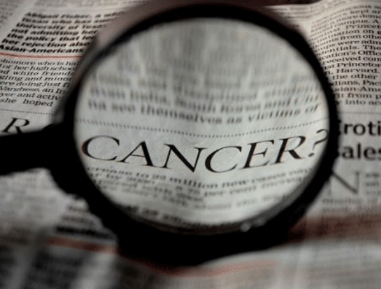 Life-Saving Oral Cancer Screening | Dentist in Livermore